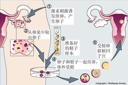 方鉴生殖医学中心